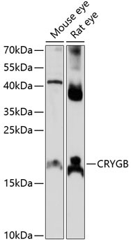 CRYGB Rabbit Polyclonal Antibody