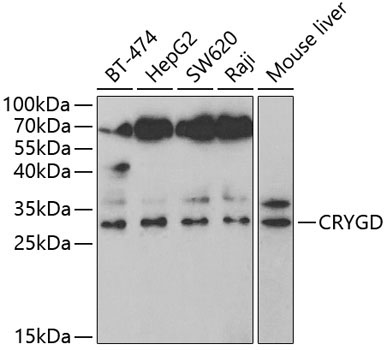 CRYGD Rabbit Polyclonal Antibody