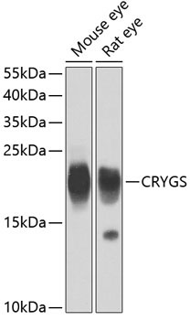 CRYGS Rabbit Polyclonal Antibody