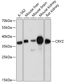 CRYZ Rabbit Polyclonal Antibody