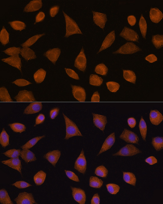CRYZ Rabbit Polyclonal Antibody - Image 2