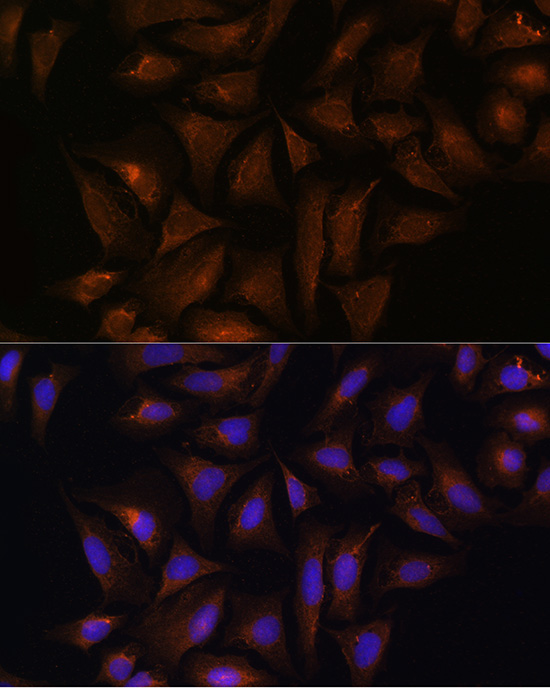 CRYZ Rabbit Polyclonal Antibody - Image 3