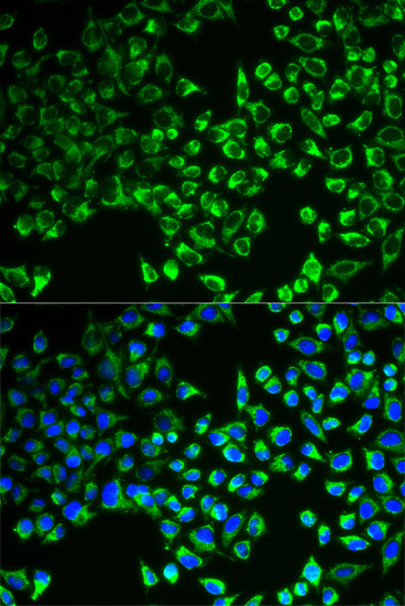 CS Rabbit Polyclonal Antibody - Image 2