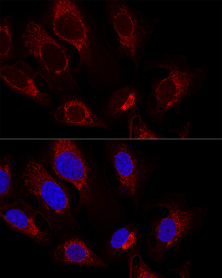 CS Rabbit Polyclonal Antibody - Image 3