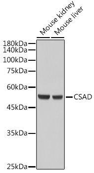 CSAD Rabbit Polyclonal Antibody