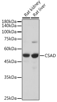 CSAD Rabbit Polyclonal Antibody - Image 2