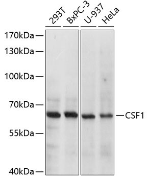 CSF1 Rabbit Polyclonal Antibody