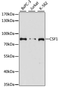 CSF1 Rabbit Polyclonal Antibody