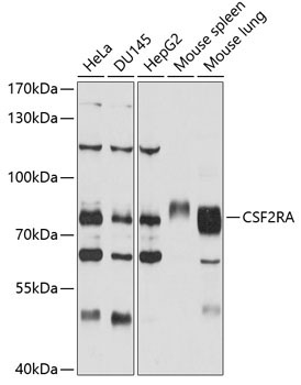 CSF2RA Rabbit Polyclonal Antibody