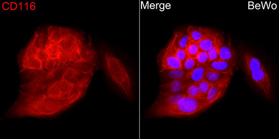 CSF2RA Rabbit Polyclonal Antibody