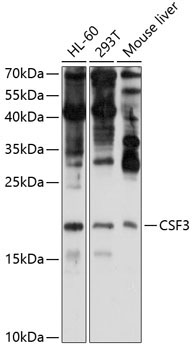 CSF3 Rabbit Polyclonal Antibody