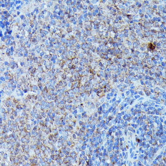 CSF3 Rabbit Polyclonal Antibody - Image 2