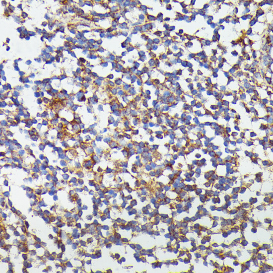 CSF3 Rabbit Polyclonal Antibody - Image 3