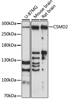 CSMD2 Rabbit Polyclonal Antibody