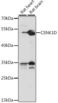 CSNK1D Rabbit Polyclonal Antibody