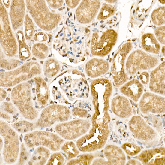CSNK1E Rabbit Polyclonal Antibody - Image 2