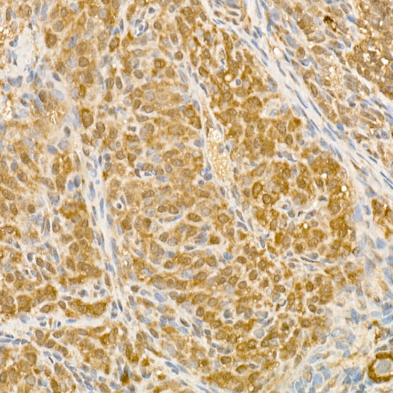 CSNK1E Rabbit Polyclonal Antibody - Image 3