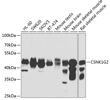 CSNK1G2 Rabbit Polyclonal Antibody