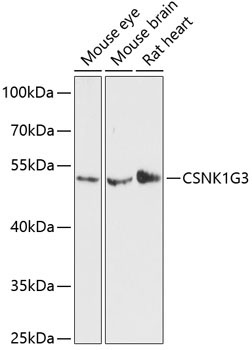 CSNK1G3 Rabbit Polyclonal Antibody