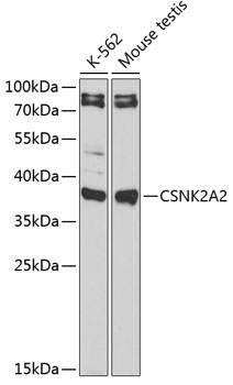 CSNK2A2 Rabbit Polyclonal Antibody