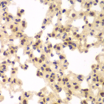CSNK2A2 Rabbit Polyclonal Antibody - Image 2