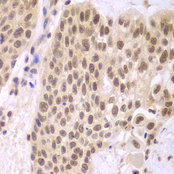 CSNK2A2 Rabbit Polyclonal Antibody - Image 3