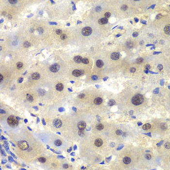 CSNK2A2 Rabbit Polyclonal Antibody - Image 4