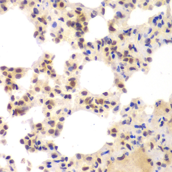 CSNK2A2 Rabbit Polyclonal Antibody - Image 5