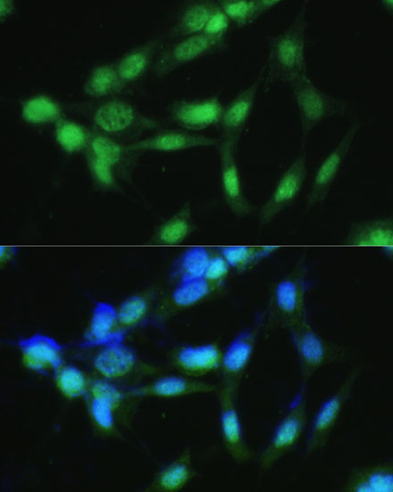 CSNK2A2 Rabbit Polyclonal Antibody - Image 6