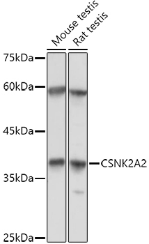 CSNK2A2 Rabbit Polyclonal Antibody