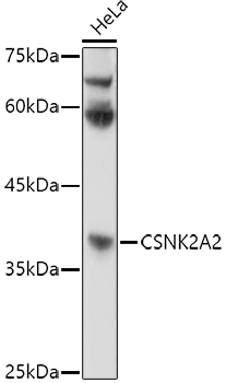 CSNK2A2 Rabbit Polyclonal Antibody - Image 2