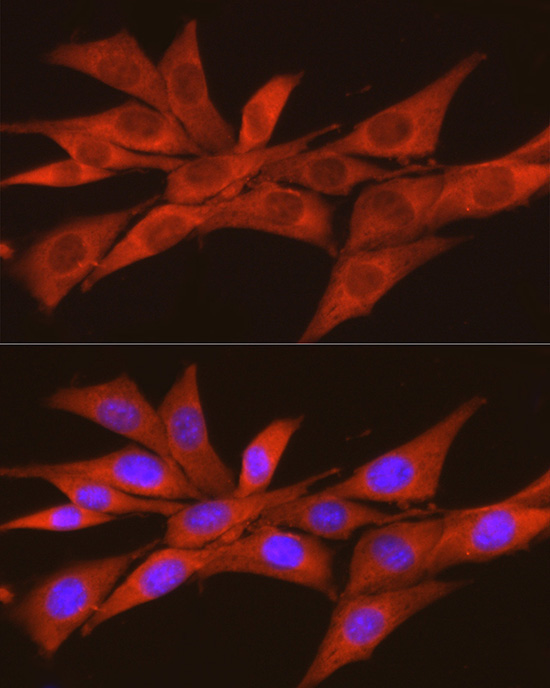 CSNK2A2 Rabbit Polyclonal Antibody - Image 3