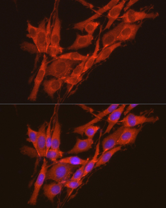 CSNK2A2 Rabbit Polyclonal Antibody - Image 4