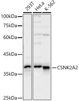 CSNK2A2 Rabbit Polyclonal Antibody