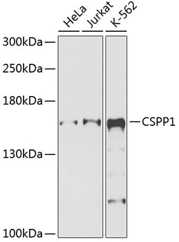 CSPP1 Rabbit Polyclonal Antibody