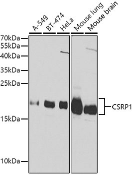 CSRP1 Rabbit Polyclonal Antibody