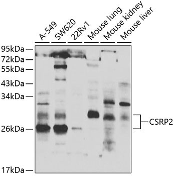 CSRP2 Rabbit Polyclonal Antibody
