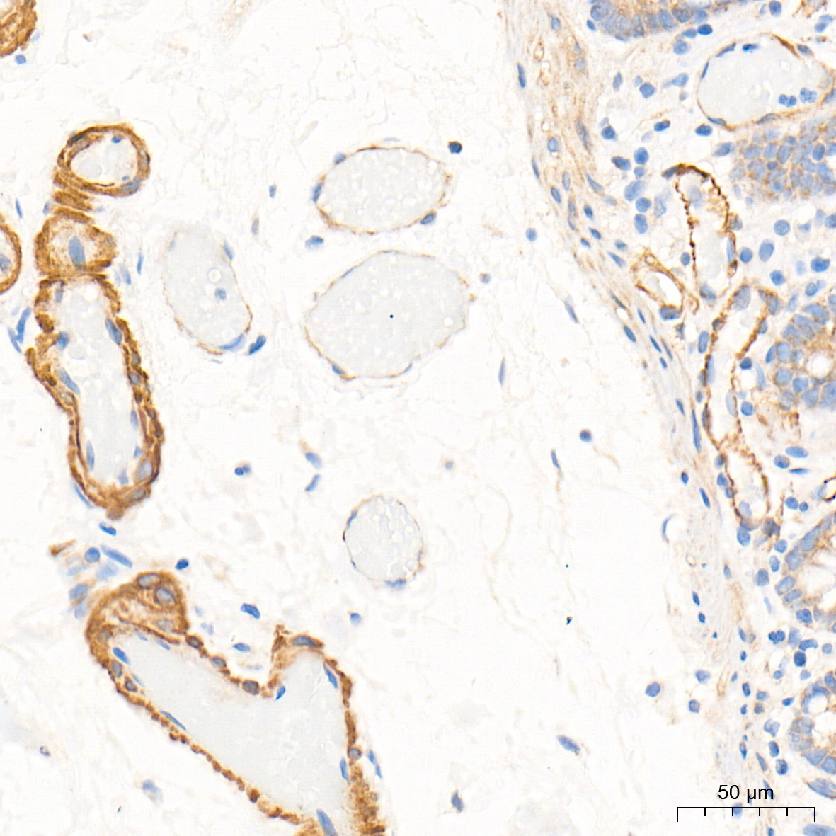 CSRP2 Rabbit Polyclonal Antibody - Image 2