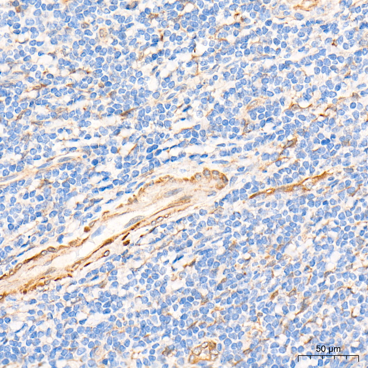 CSRP2 Rabbit Polyclonal Antibody - Image 3