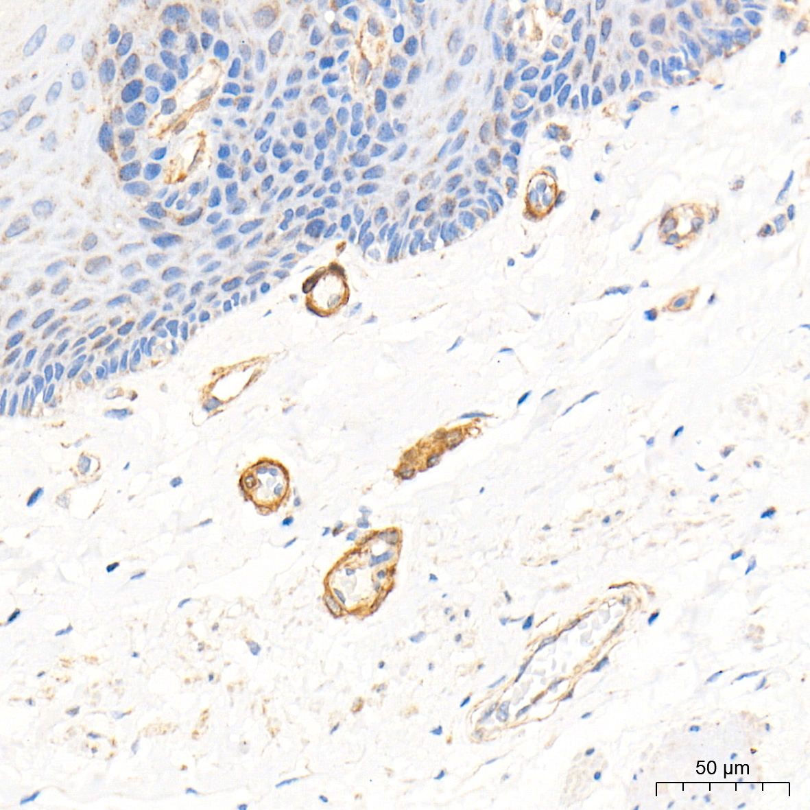 CSRP2 Rabbit Polyclonal Antibody - Image 4