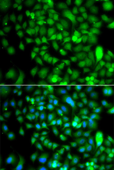 CSRP2BP Rabbit Polyclonal Antibody - Image 2