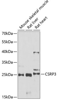 CSRP3 Rabbit Polyclonal Antibody