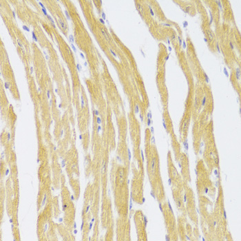 CSRP3 Rabbit Polyclonal Antibody - Image 2
