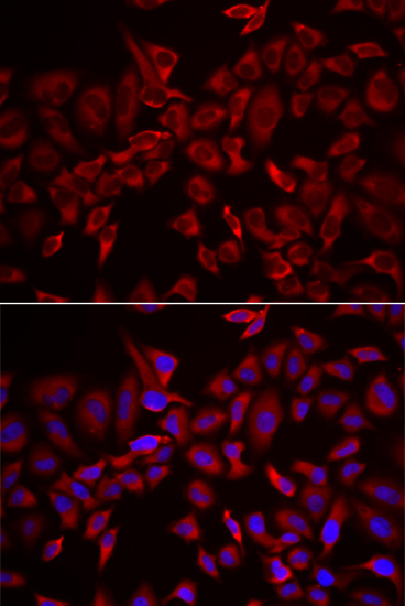 CSRP3 Rabbit Polyclonal Antibody - Image 3