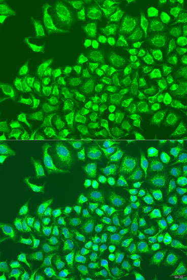 CST6 Rabbit Polyclonal Antibody - Image 2