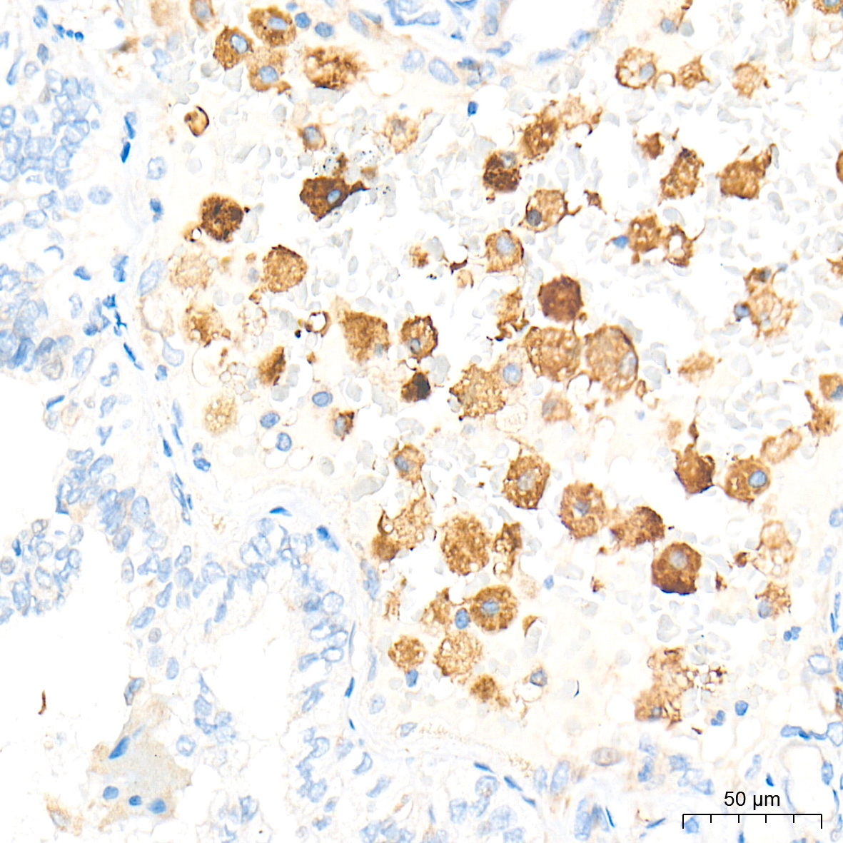 CST7 Rabbit Polyclonal Antibody - Image 2