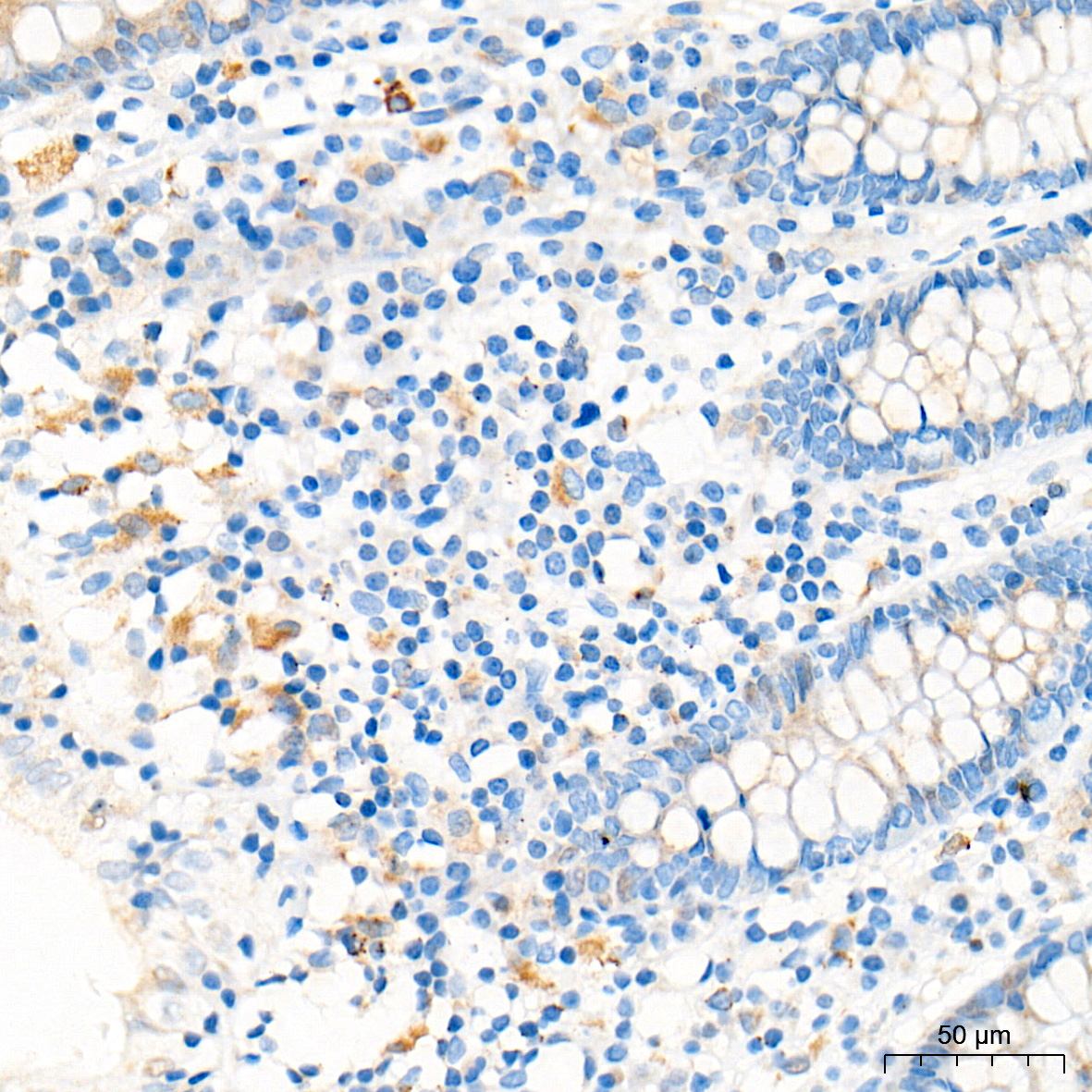 CST7 Rabbit Polyclonal Antibody - Image 3