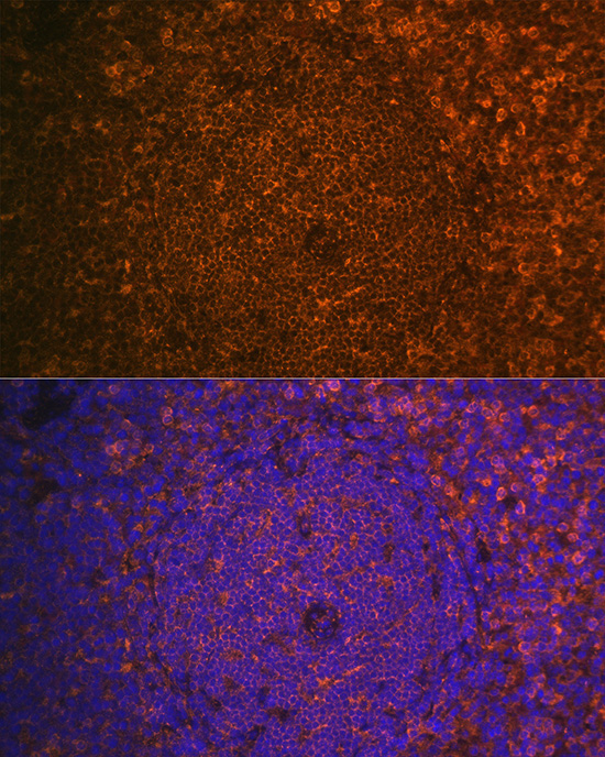 CST7 Rabbit Polyclonal Antibody - Image 4