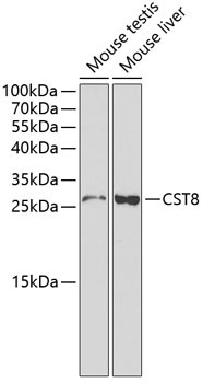 CST8 Rabbit Polyclonal Antibody