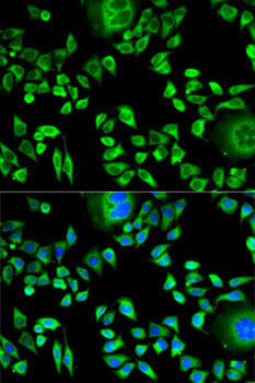 CSTA Rabbit Polyclonal Antibody - Image 2